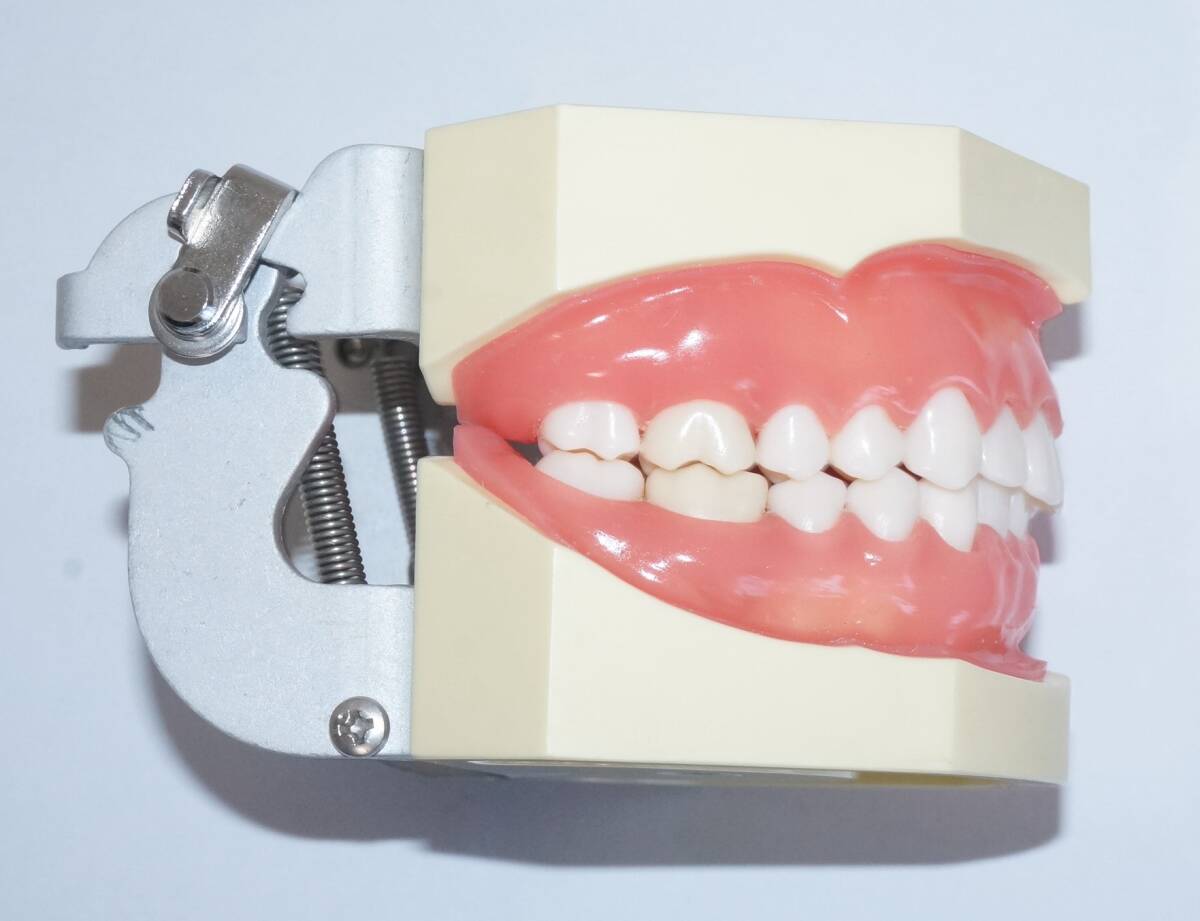 NISSIN 歯周病 歯科 模型 歯周外科 顎模型 歯科衛生士 ニッシン スケーリング スケーラー SRP 歯肉 歯石 マネキン 超音波 ペリオ 額模型_画像4