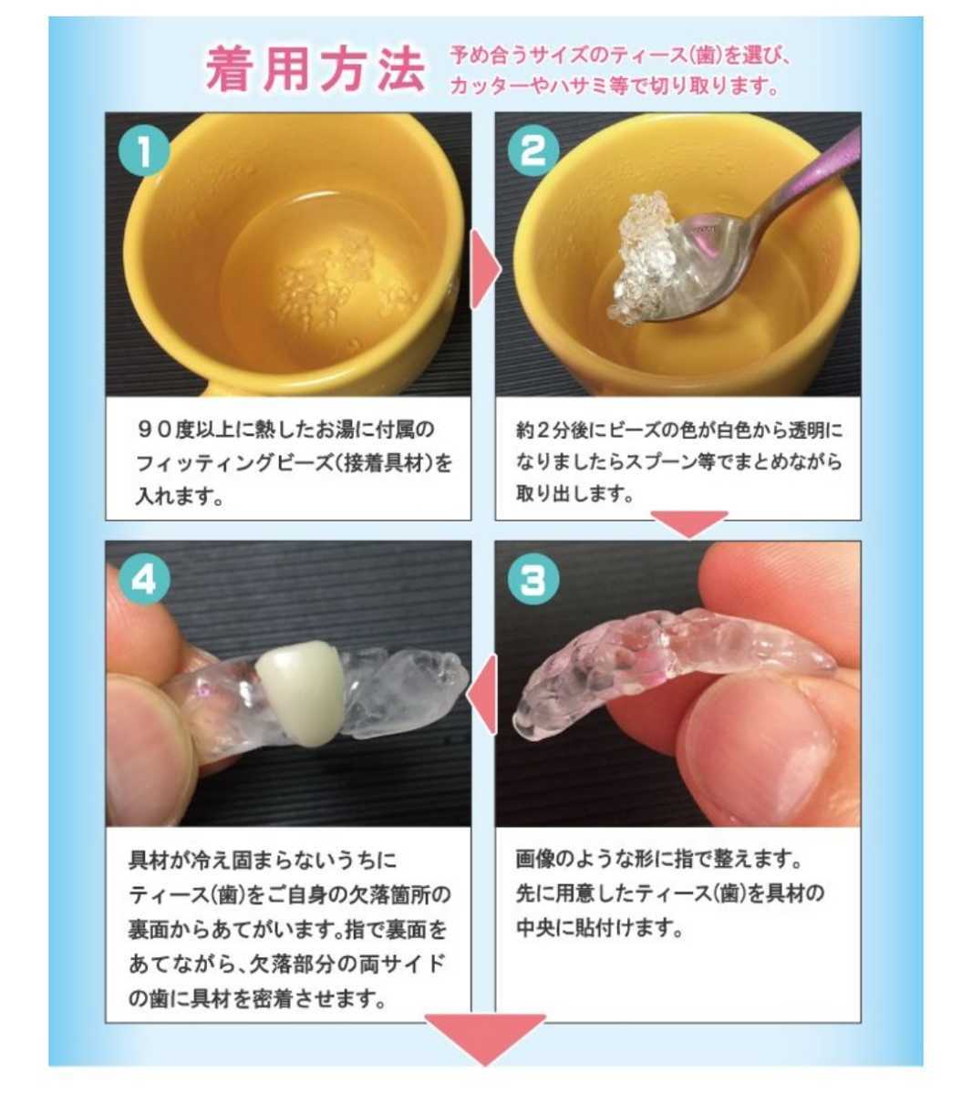  temporary toe s temporary tooth difference . tooth artificial tooth fitting beads attaching ③