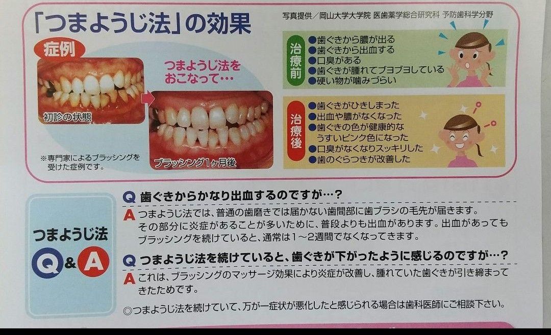 V-7 ブイセブン コンパクトヘッド 5本 (ふつう)