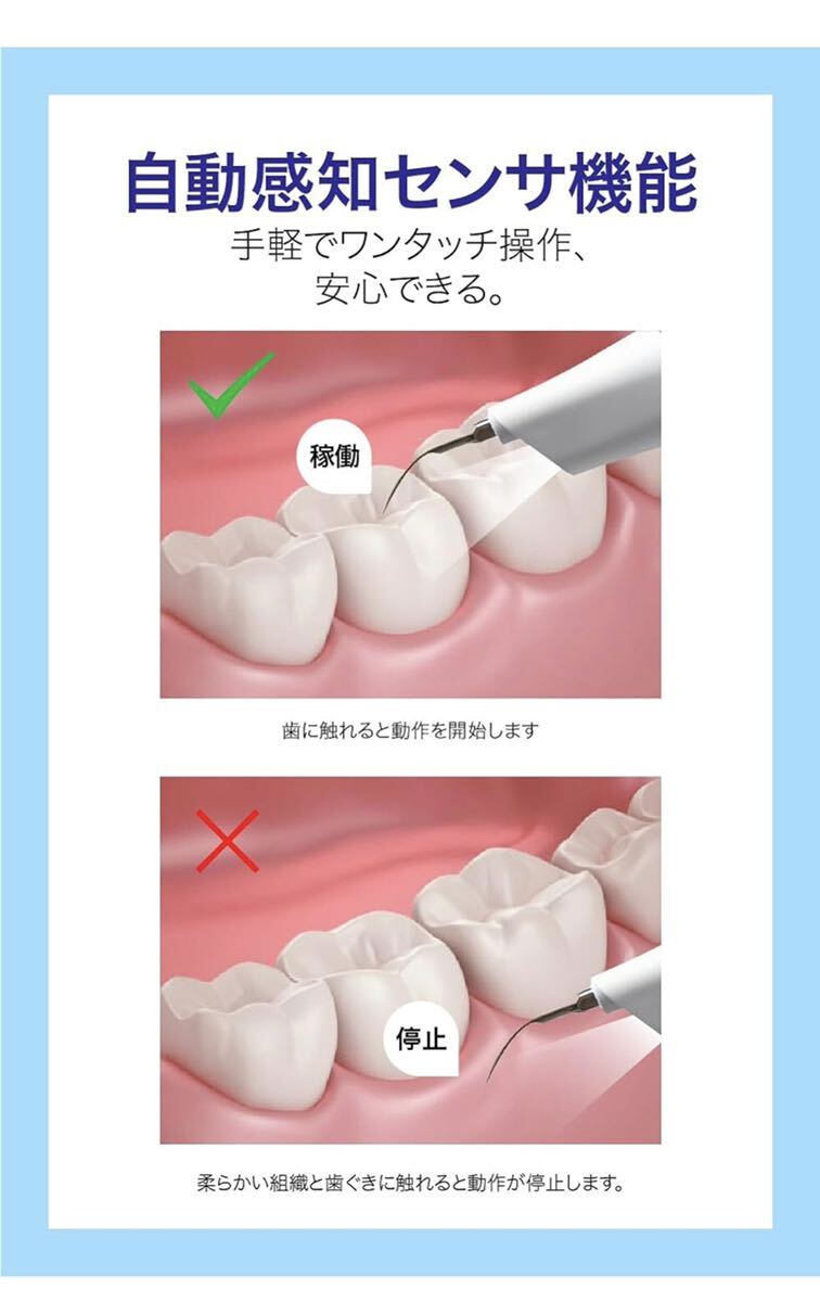 SIWING 超音波歯間クリーナー 歯 クリーナー 口腔洗浄器 家庭用歯清潔器 USB 充電式 携帯用歯清潔器 クリーニング 高周波振動 IPX6防水_画像6