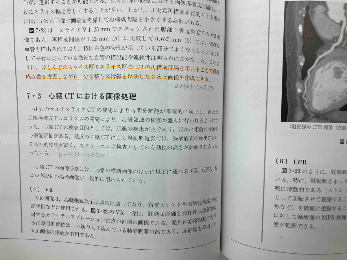 診療放射線技師　7冊まとめ　国家試験問題集　診療画像機器学　MRI CT 放射線治療技術学_画像9