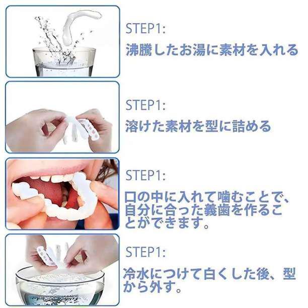 マウスピース 矯正 つけ歯 入れ歯 義歯 オーラルケア ホワイトニング かぶせ