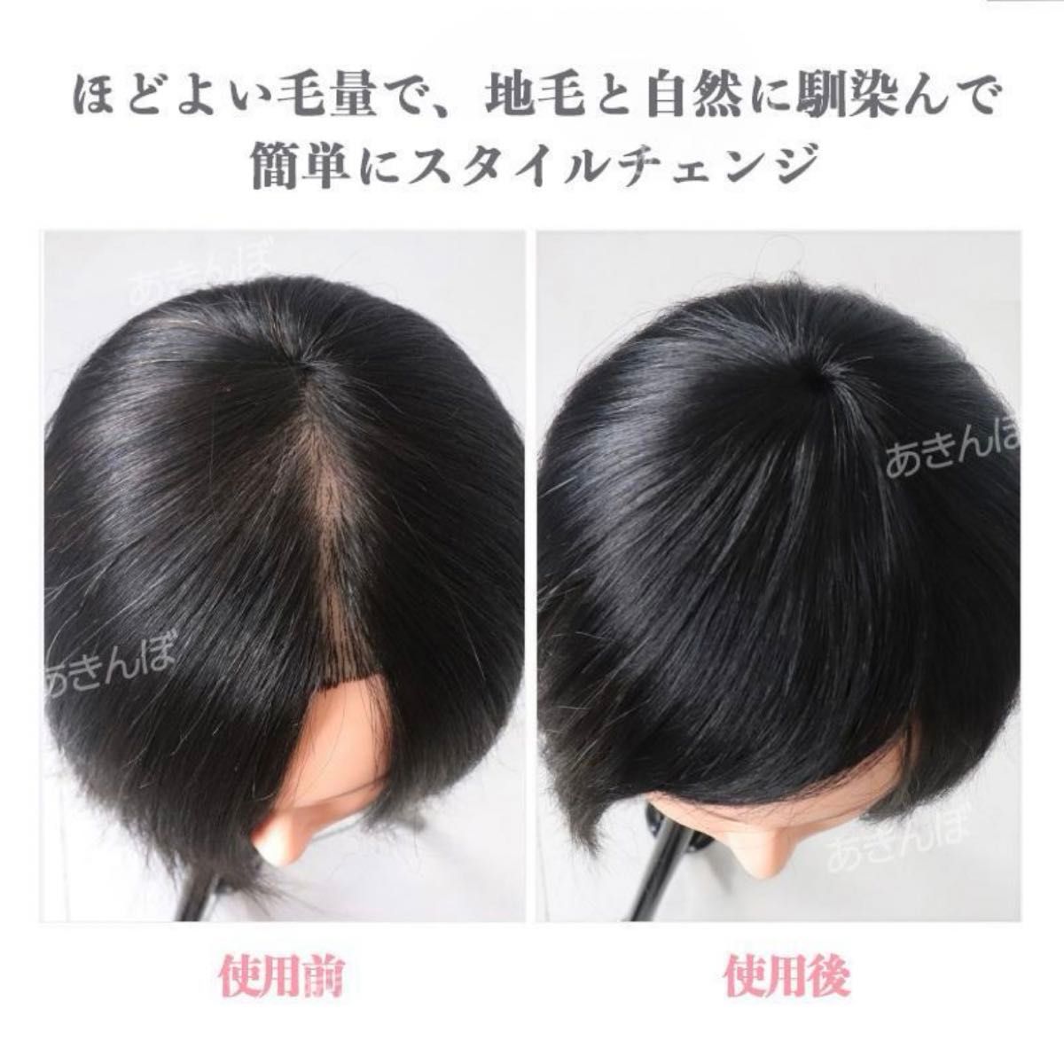 人毛 100% 新品 ダーク ブラウン 茶 頭頂部 ウィッグ 部分 かつら つけ毛 ヘアピース 自然 ナチュラル 薄毛 白髪隠し