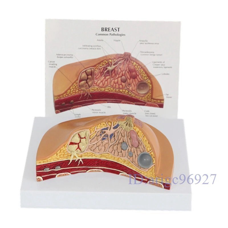 X464☆新品教材型 大学 テーブル乳房 病変 モデル 授乳 胸 医学用 完成品 模型 1:1 中央値 クションセ 女性 乳房 病理 解剖 モデル_画像1