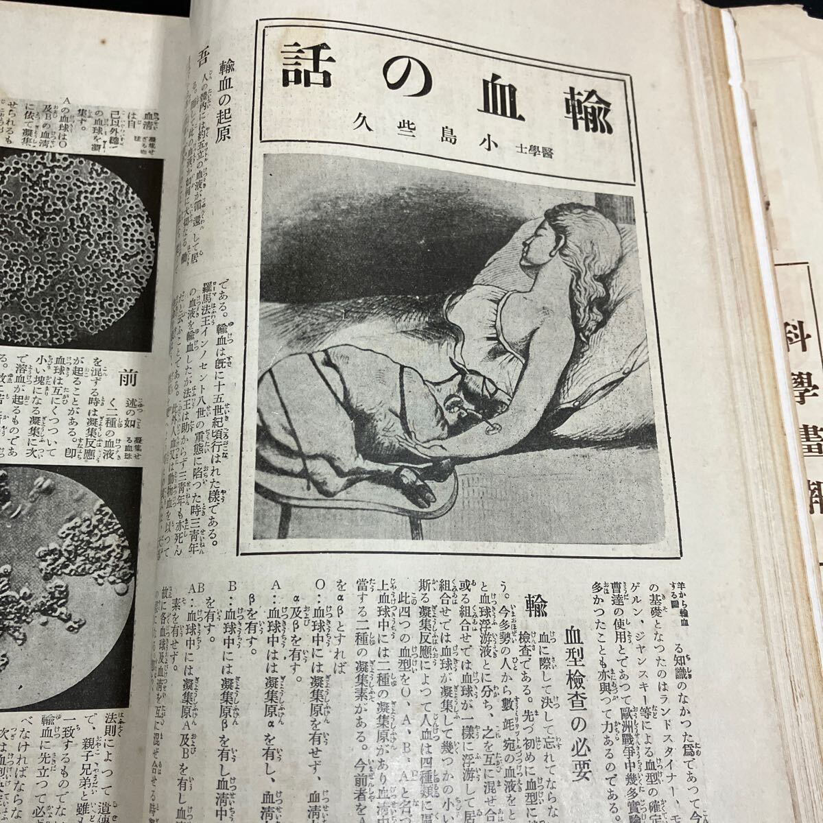 『 科学画報　昭和4年11月号　最新外科手術の驚異 』科学画報社　戦前の雑誌　レトロ_画像5