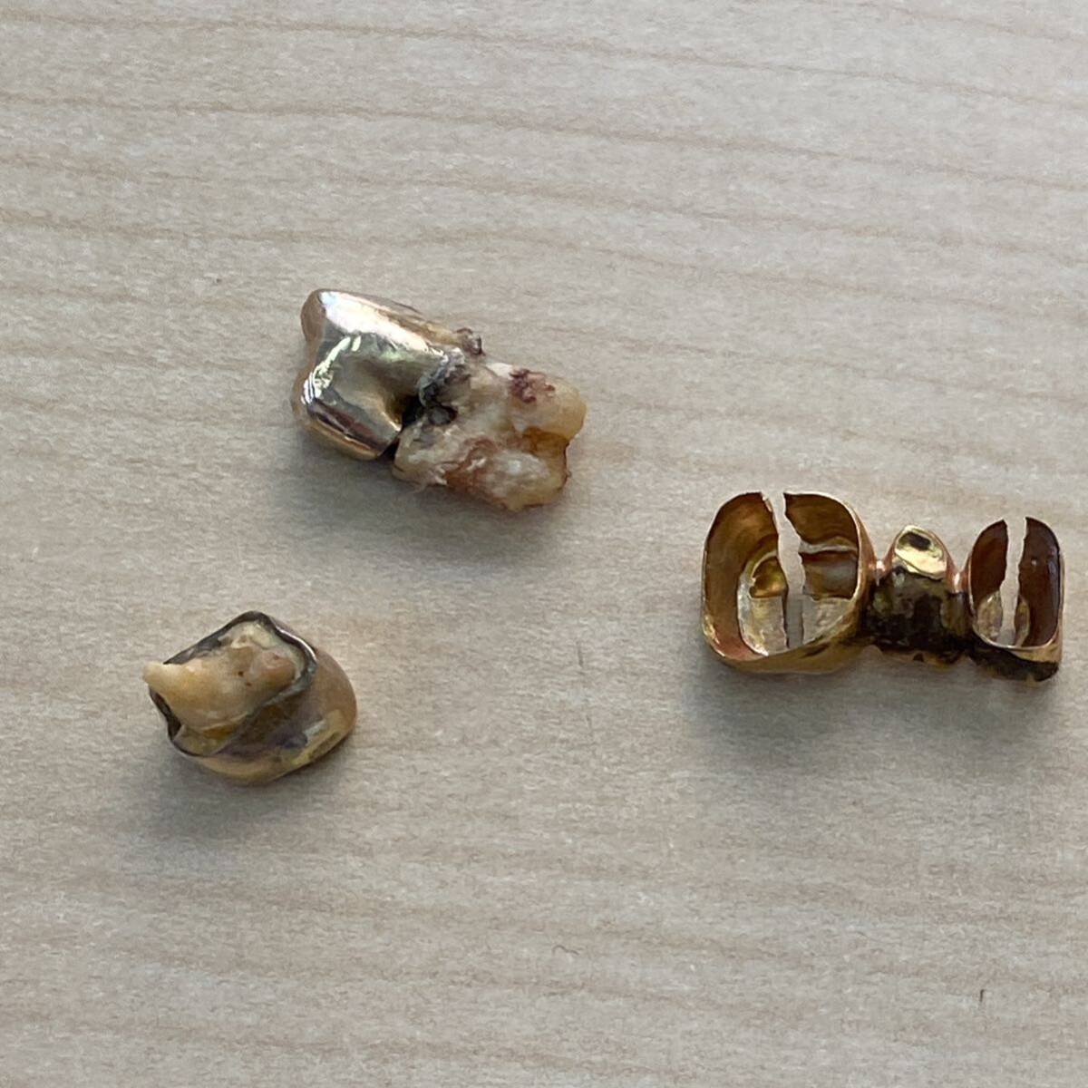 【TK0511】 金歯 セメント付き 歯付き 約16ｇ 歯科用素材 金 ゴールド キズあり 汚れあり 詳細不明_画像3