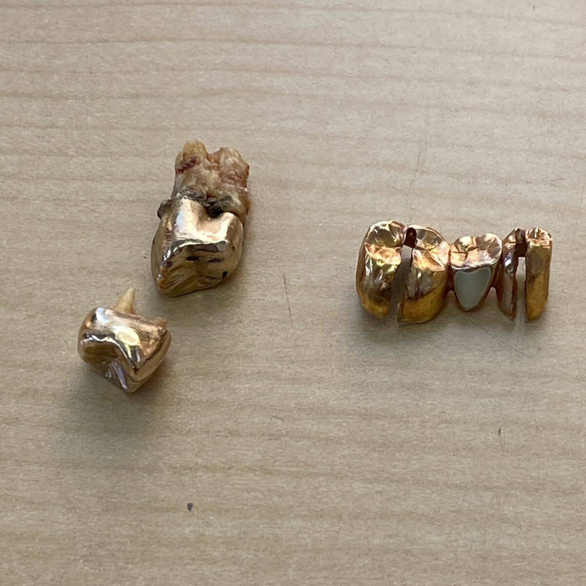 【TK0511】 金歯 セメント付き 歯付き 約16ｇ 歯科用素材 金 ゴールド キズあり 汚れあり 詳細不明_画像2
