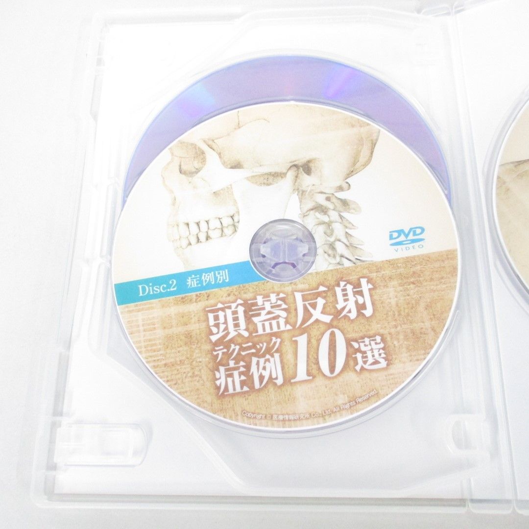 ●01)【同梱不可】頭蓋反射テクニック症例10選/熊谷剛/DVD3枚組/医療情報研究所/A_画像4