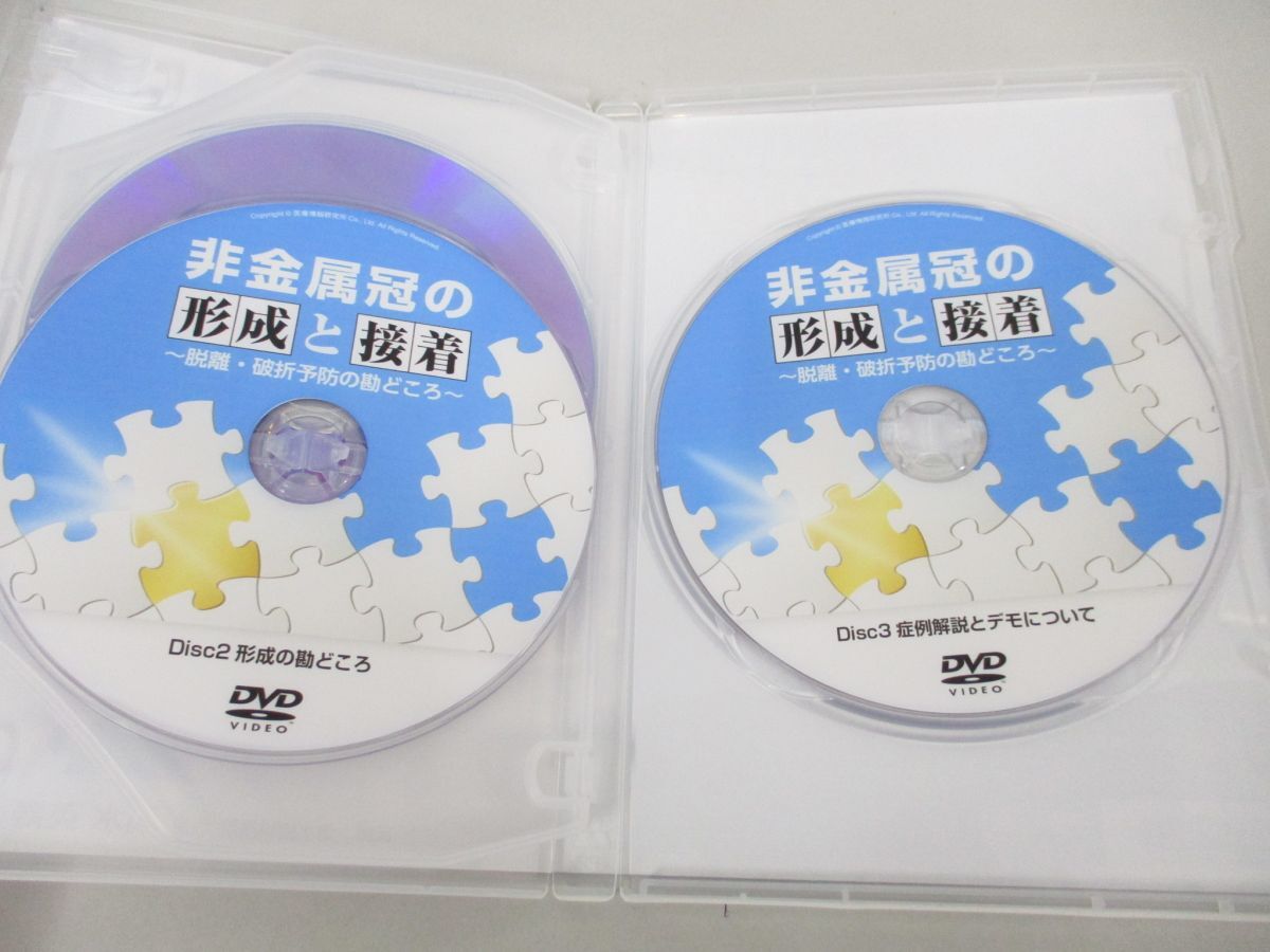 ●01)【同梱不可】非金属冠の形成と接着/脱離・破折予防の勘どころ/清水英寿/DVD3枚組+冊子セット/A_画像4