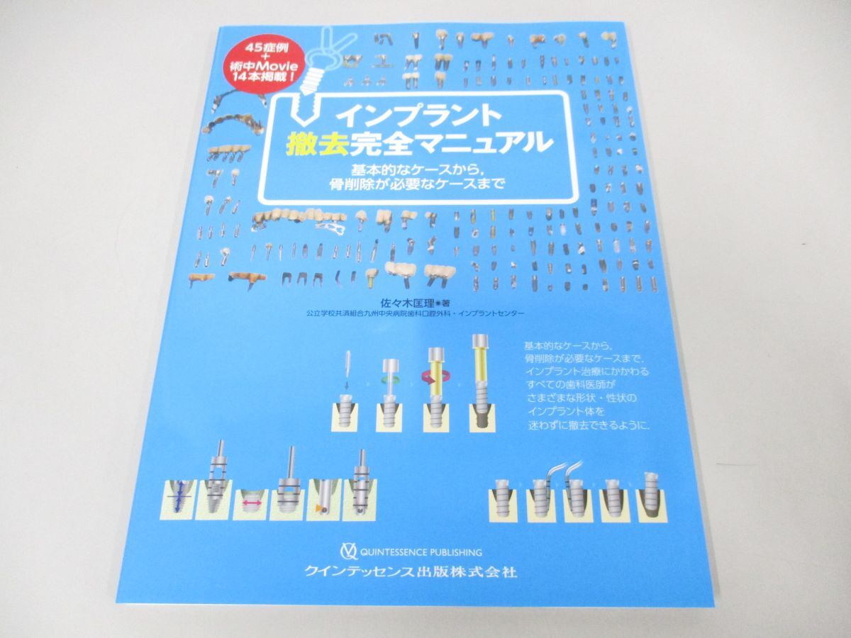 ●01)【同梱不可】インプラント撤去完全マニュアル/基本的なケースから、骨削除が必要なケースまで/佐々木匡理/クインテッセンス出版/A_画像1