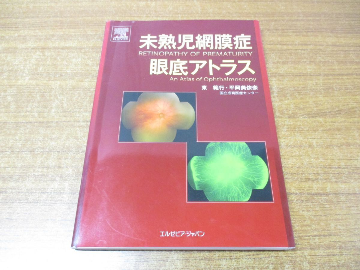 レビュー高評価の商品! ▲01)【同梱不可】未熟児網膜症眼底アトラス/東範行/平岡美依奈/エルゼビア・ジャパン/2009年発行/A 医学一般