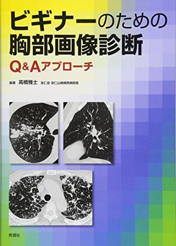 [A01468687]ビギナーのための胸部画像診断 Q&Aアプローチ ?橋 雅士_画像1