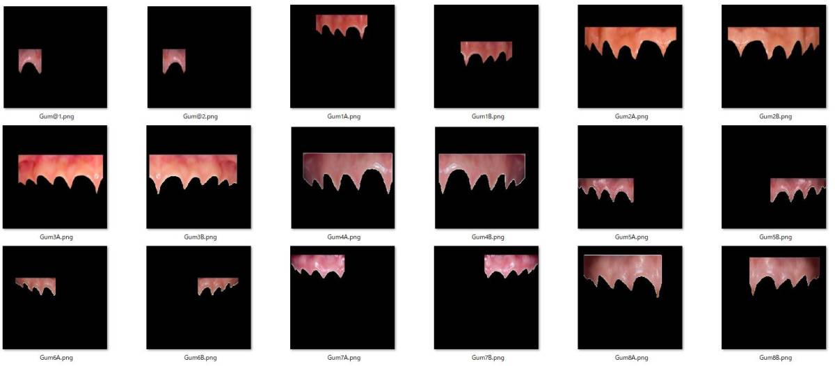 歯科　歯科技工　デジタルデンタルパーツ　スマイルデザイン用　カラーテンプレート＋ラインテンプレート＋ゴールデンプロポーションガイド_画像9