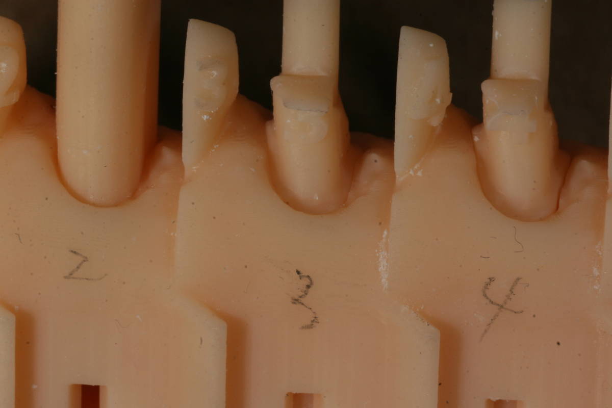 歯科　歯科技工　meshmixerを使用したシンプルな手順と時間を要さない支台歯が抜けるプリントモデルデータ作成方法_画像8