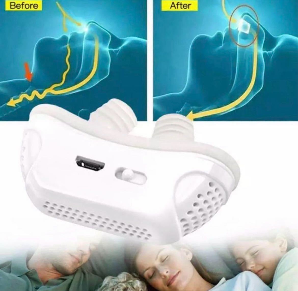 いびき防止　グッズ　無呼吸　対策　快適　睡眠_画像3