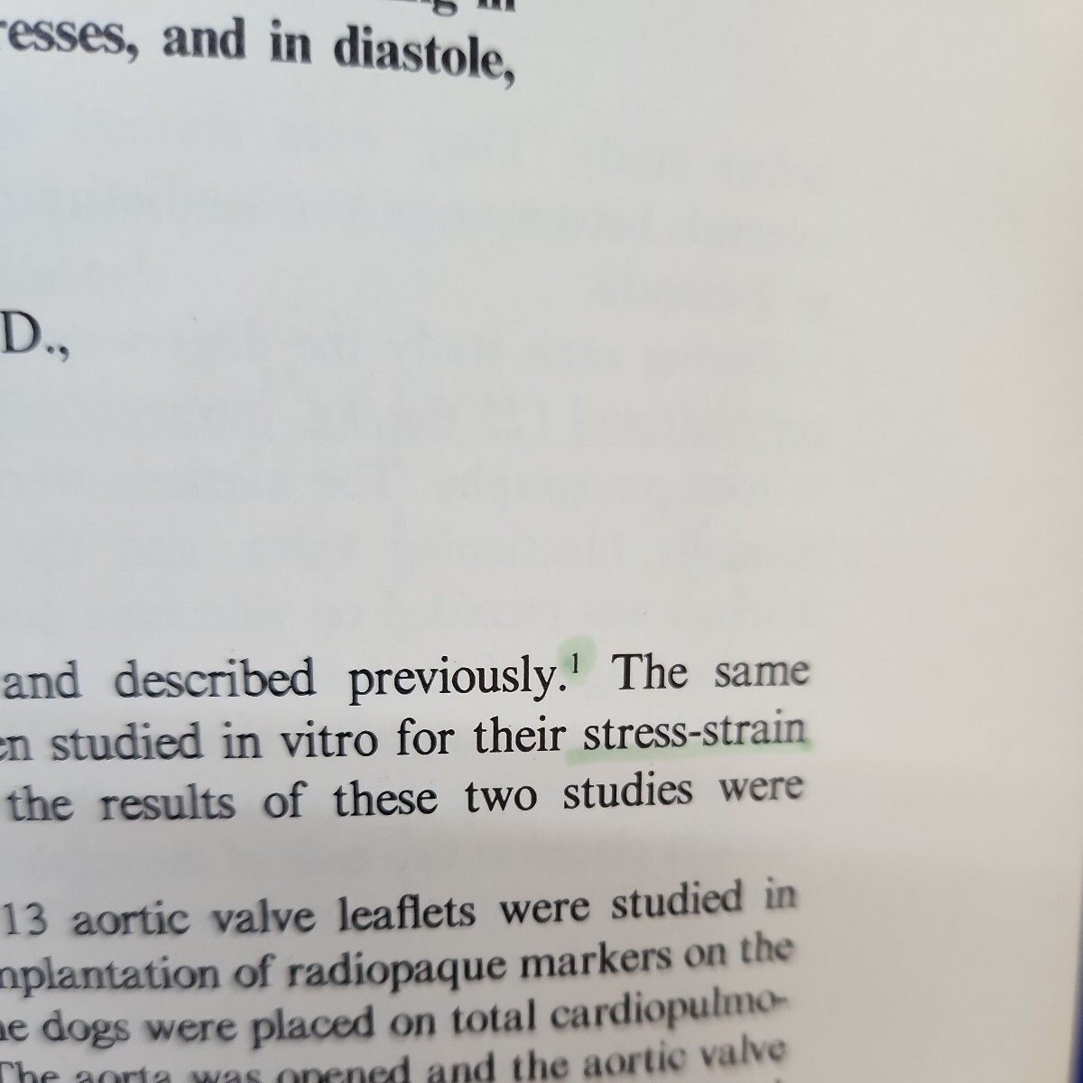 B64-192 Vol.92, No.1(1-168) The Journal of THORACIC AND CARDIOVASCULAR SURGERY July,1986 印、線引き、書き込みあり - 医学一般 B64-192 Vol.92, No.1(1-168) The Journal of THORACIC AND CARDIOVASCULAR SURGERY July,1986 印、線引き、書き込みあり - 医学一般