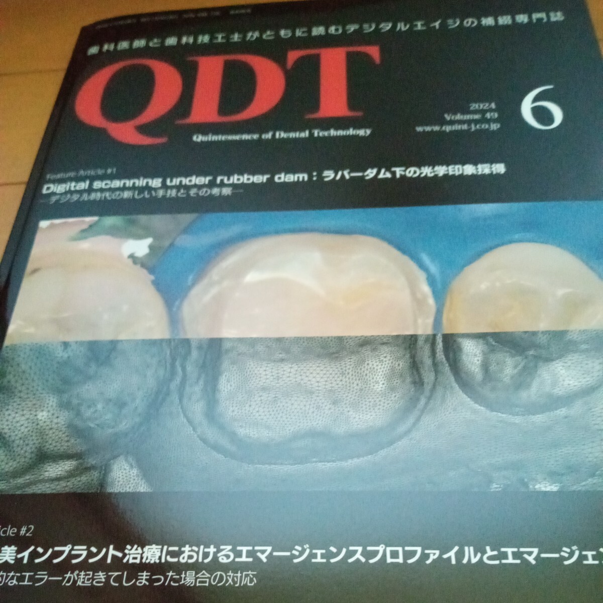 2024年度 歯科技工 Yahoo!オークション - 歯科 歯科技工 本 QDT 2024年6月号 最新号
