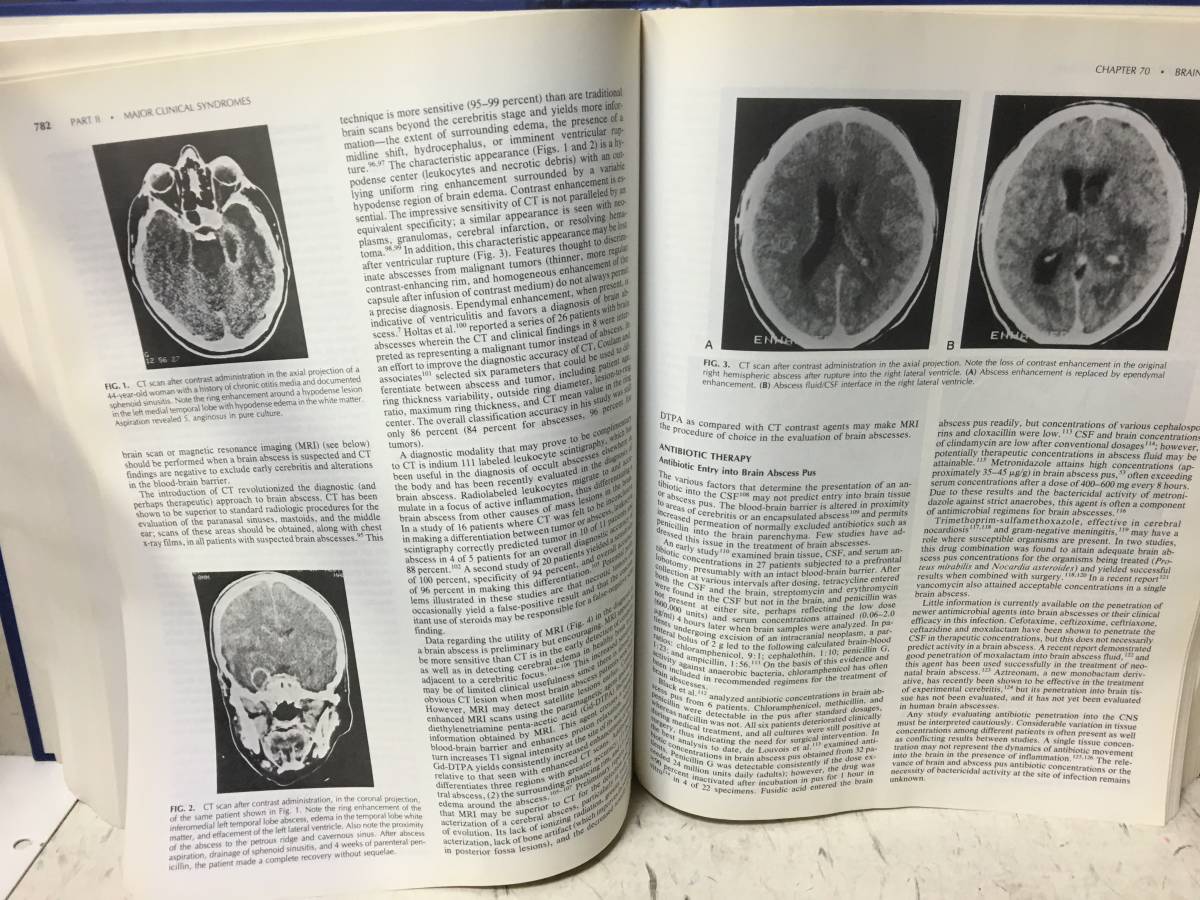  prompt decision hospital pay lowering book@Principles and Practice of Infectious Diseases VOL.1 medicine foreign book * large book