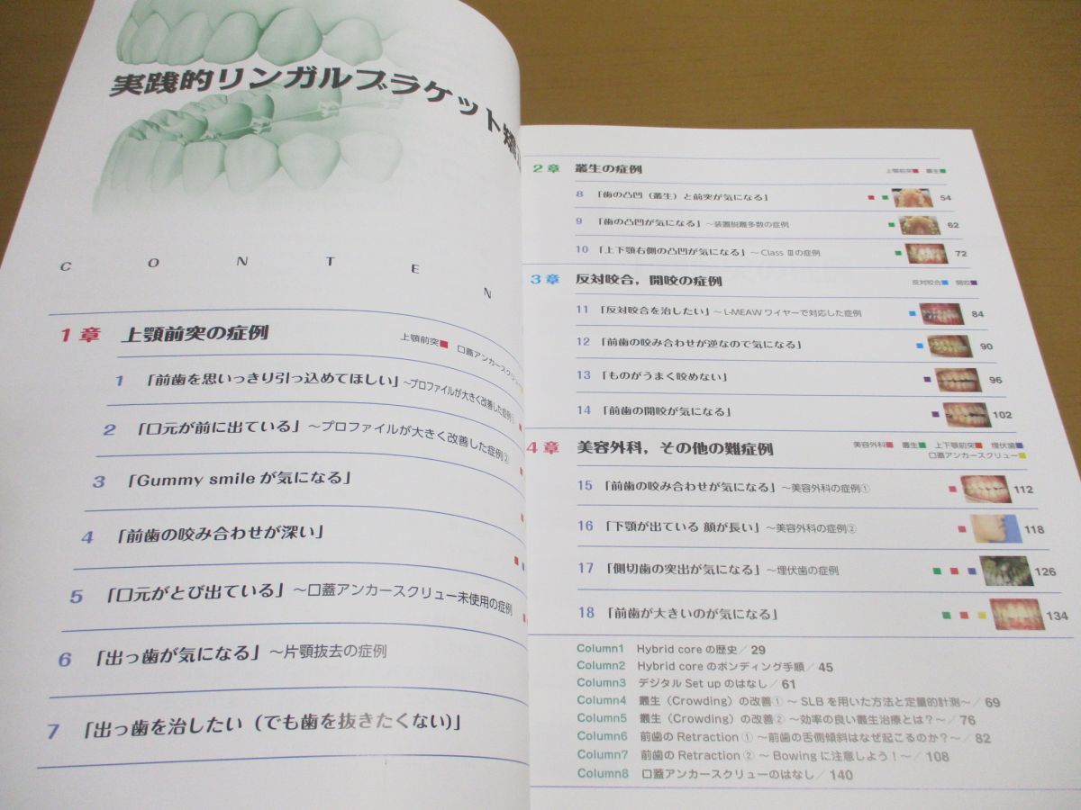 △01)【同梱不可】実践的リンガルブラケット矯正/松野功/医歯薬出版/2023年/A - 歯科学 △01)【同梱不可】実践的リンガルブラケット矯正/松野功/医歯薬出版/2023年/A - 歯科学