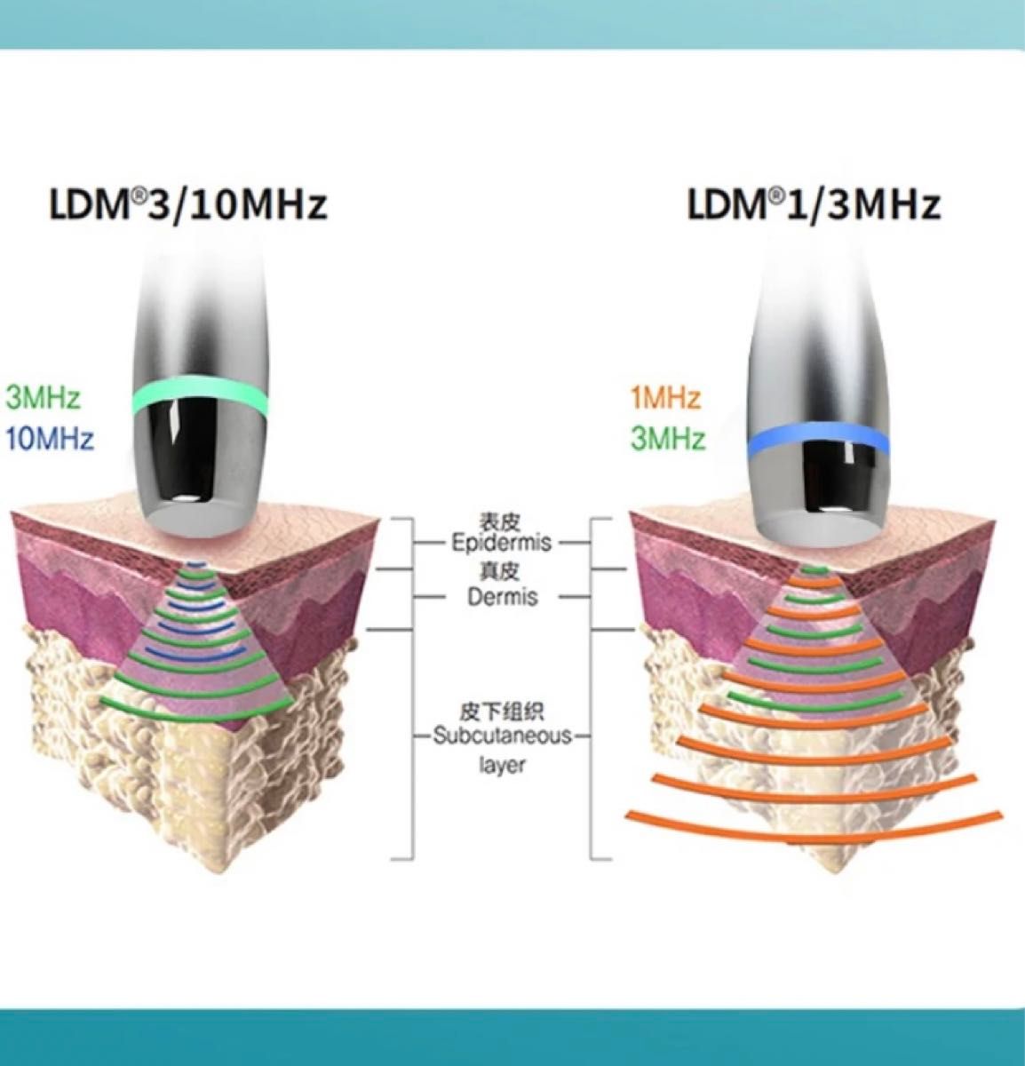 i-cool 水玉リフティング LDM SONOと同等マシン 韓国肌管理 i-cool 水玉リフティング LDM SONOと同等マシン 韓国肌管理