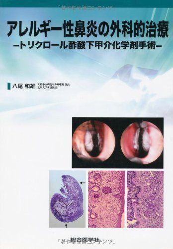 [A01980217]アレルギー性鼻炎の外科的治療―トリクロール酢酸下甲介化学剤手術 [単行本] 八尾 和雄