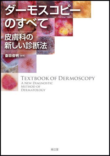 [A01216695]ダーモスコピーのすべて 斎田 俊明