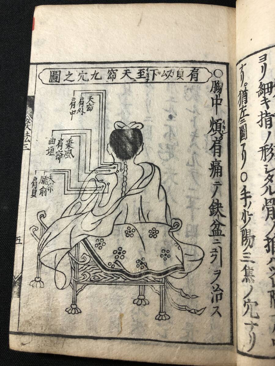 Yahoo!オークション - 3773医学 鍼灸 経穴 ツボ 絵入 図解 灸法 Yahoo!オークション - 3773医学 鍼灸 経穴 ツボ 絵入 図解 灸法