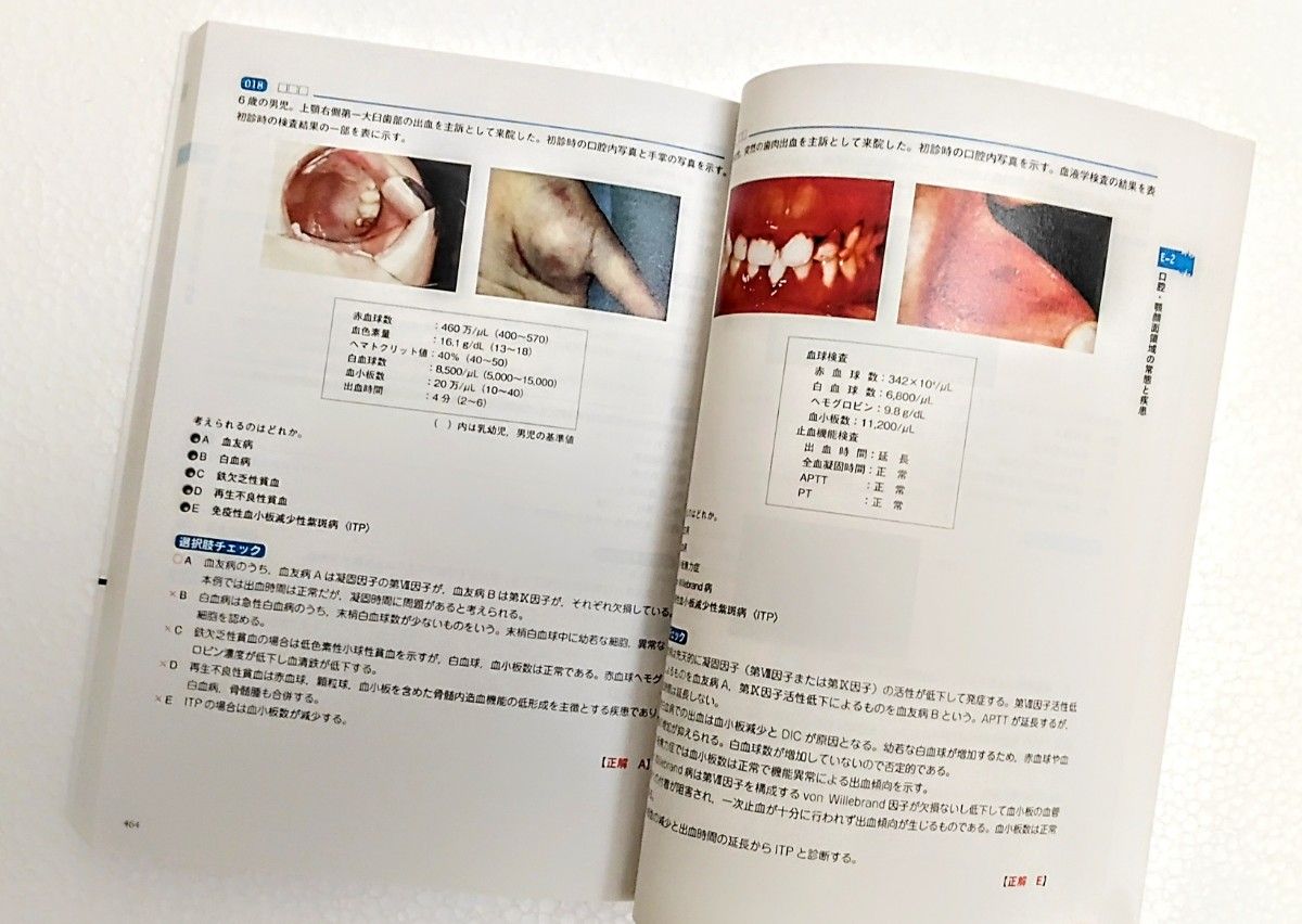 CBT ANSWER 4冊セット 全巻 歯科CBT対策|Yahoo!フリマ(旧 CBT ANSWER 4冊セット 全巻 歯科CBT対策|Yahoo!フリマ(旧