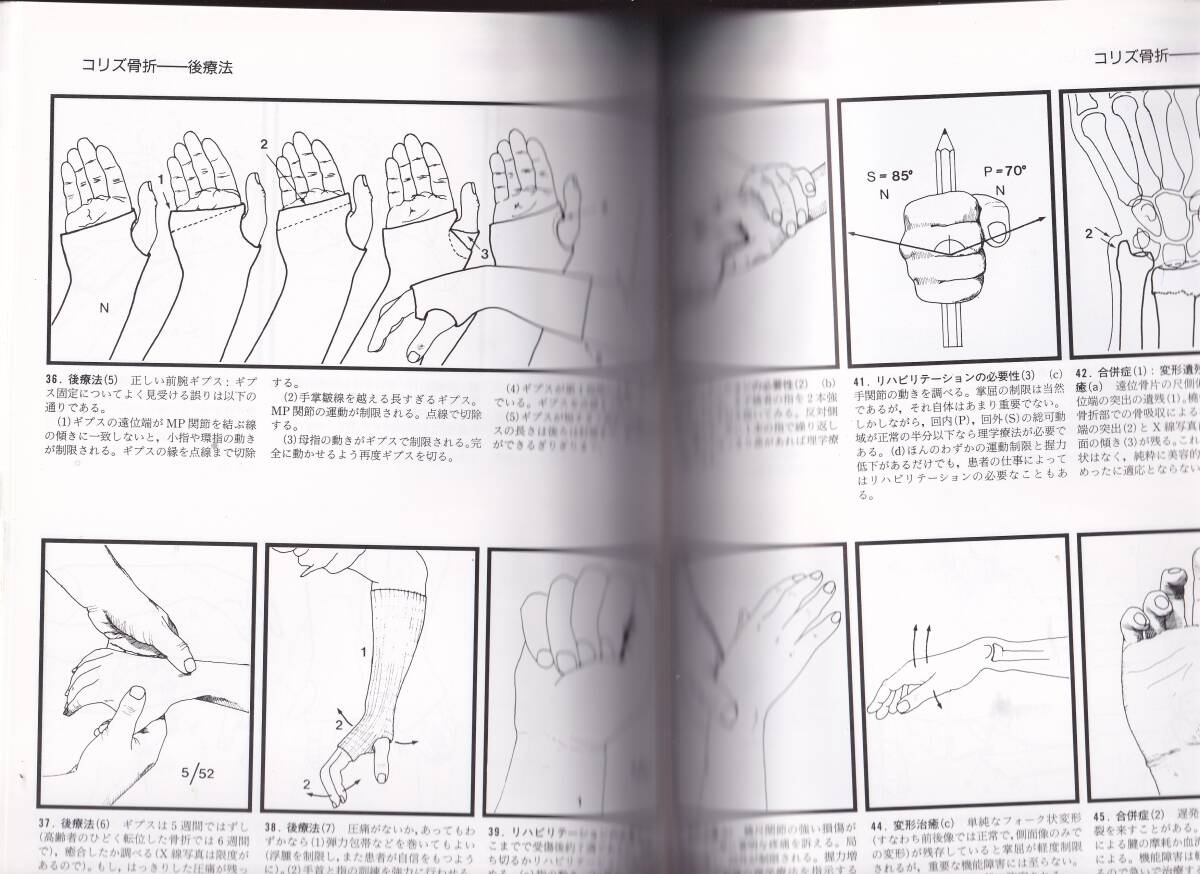 図解 骨折治療の進め方 第2版 小野啓郎監訳 医学書院 整形外科
