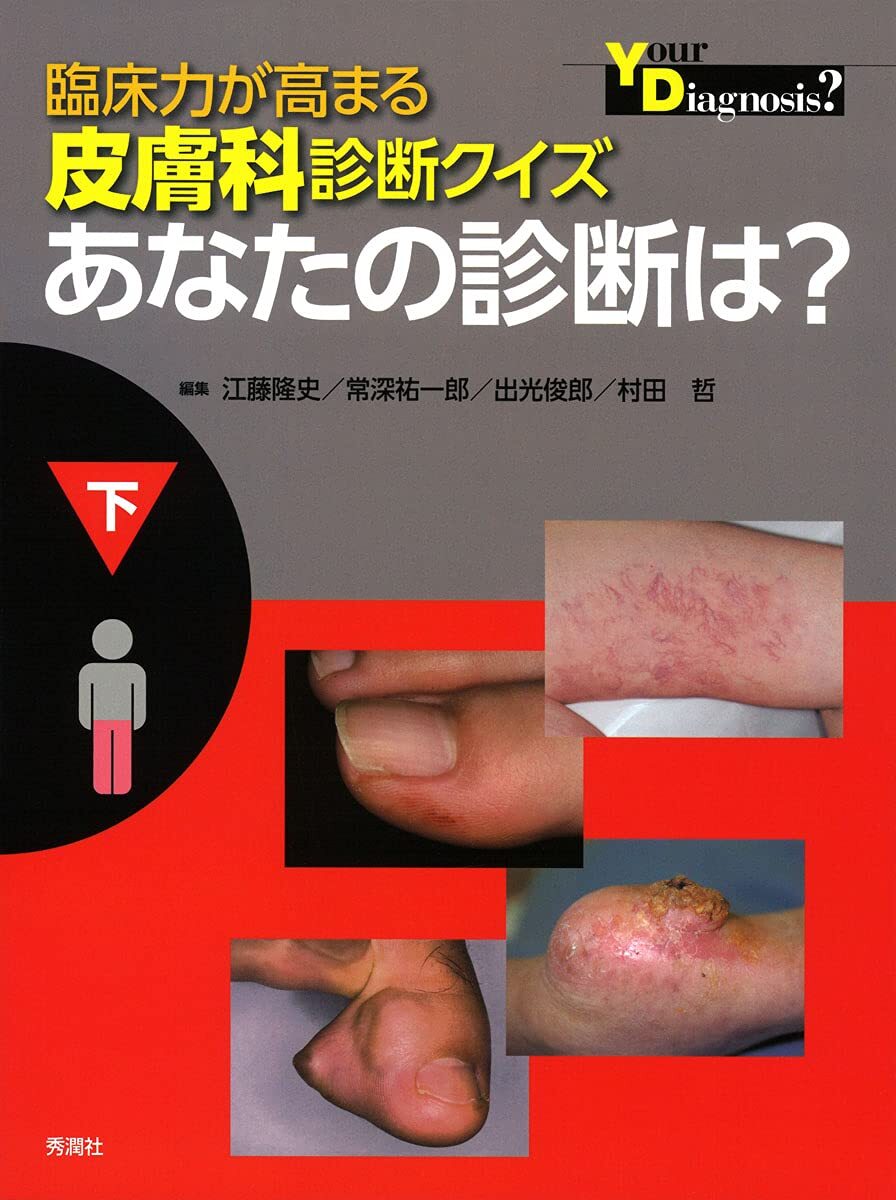【中古】臨床力が高まる皮膚科診断クイズ 下
