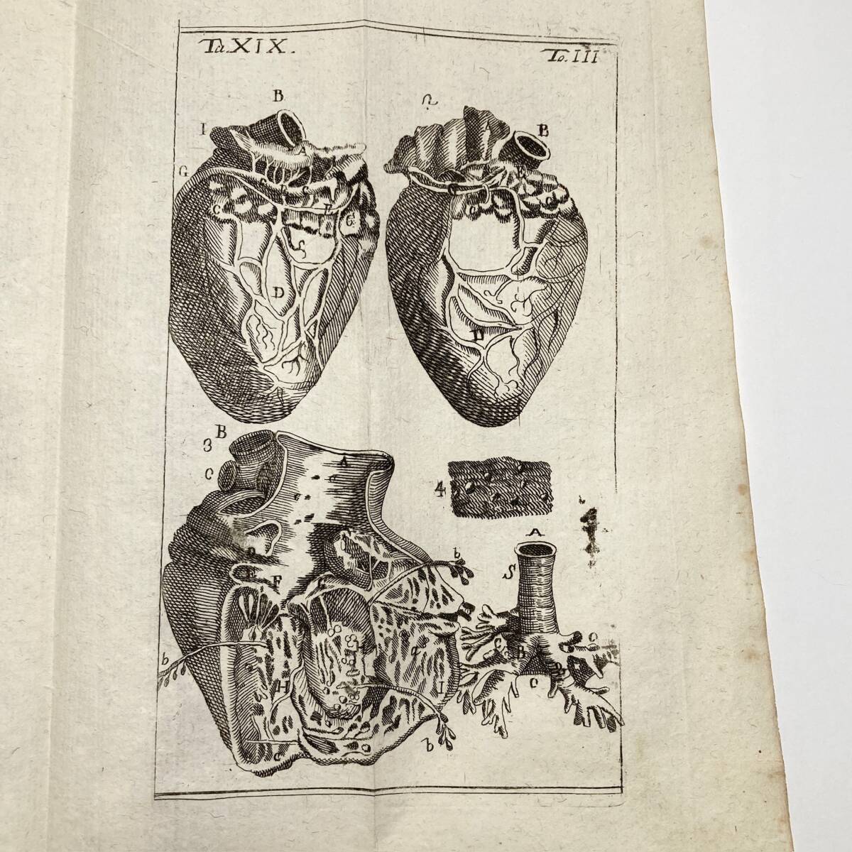 希少な医学書】1758年『ANATOMIA CHIRURGICA』第3巻 銅版画図版 希少な医学書】1758年『ANATOMIA CHIRURGICA』第3巻 銅版画図版