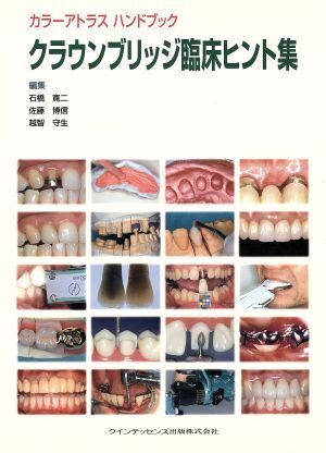 クラウンブリッジ臨床ヒント集 カラーアトラスハンドブック/石橋?qū)埗?著者),佐藤博信(著者)