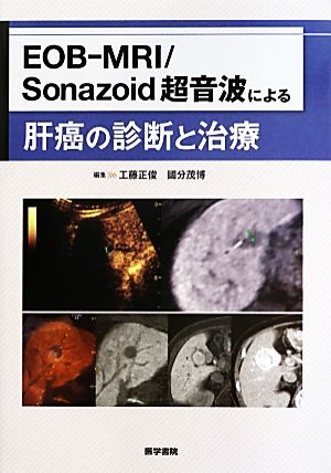 EOB-MRI/Sonazoid超音波による肝癌の診断と治療/工藤正俊(編者),國分茂博(編者)