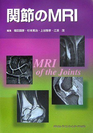 [A01494740]関節のMRI