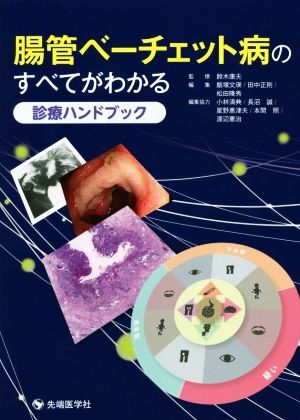 腸管ベーチェット病のすべてがわかる診療ハンドブック/飯塚文瑛(編者),田中正則(編者),松田隆秀(編者),鈴木康夫