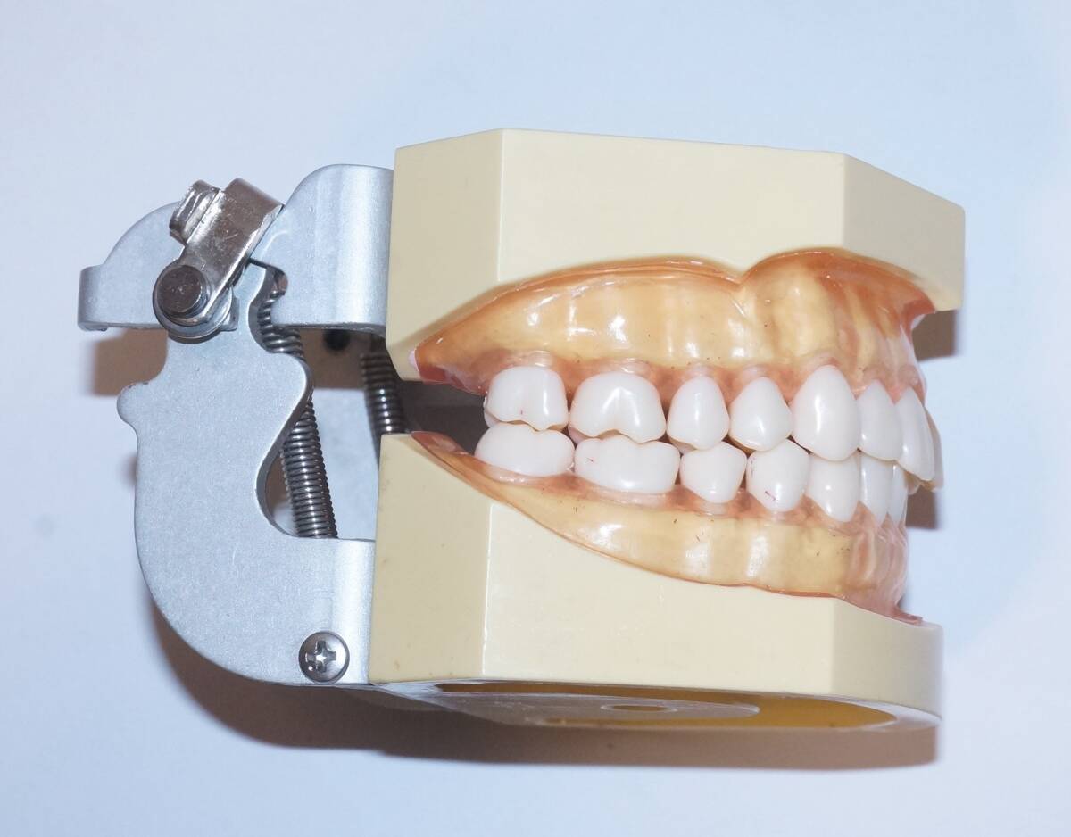 歯科衛生士 NISSIN マネキン 模型 Amazon.co.jp: 歯科 模型 ニッシン 顎模型 根管治療 エンド