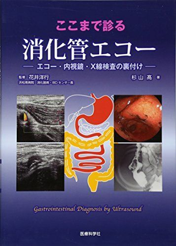 [A12033506]ここまで診る消化管エコー ―エコー・内視鏡・X線検査の裏付け