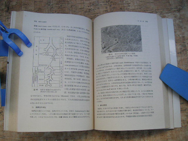 ∞　小病理学　梶田昭、著　南山堂、刊　1978年・第１版　●40年以上前の古書です●_画像8