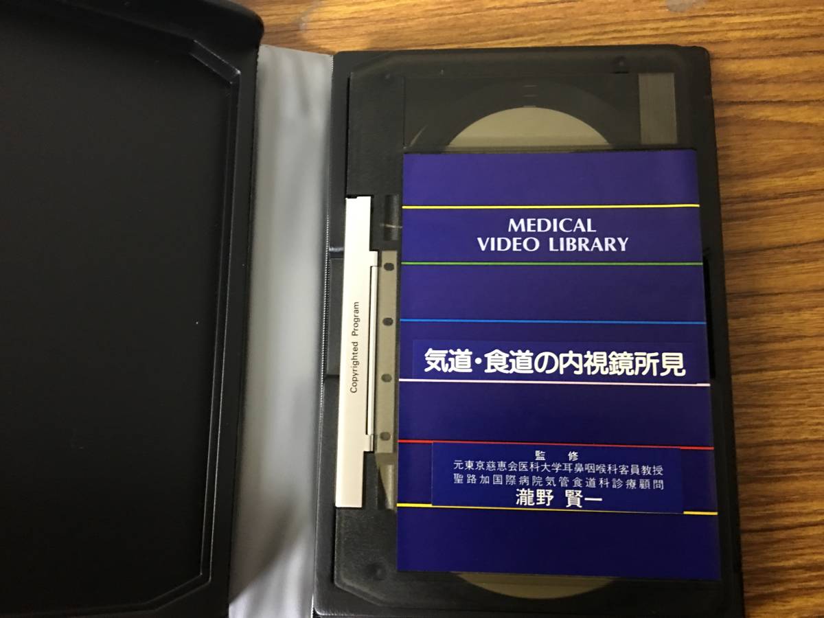 即決 病院払い下げ品　MEDICAL VIDEO LIBRARY・気道・食道の内視鏡所見・瀧野賢一_画像6