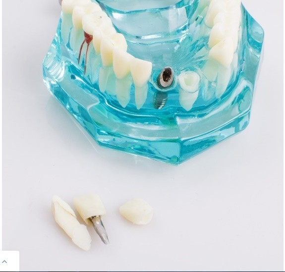 M287 Demshine зуб . изучение зуб прозрачный . человек патология . зуб модель 