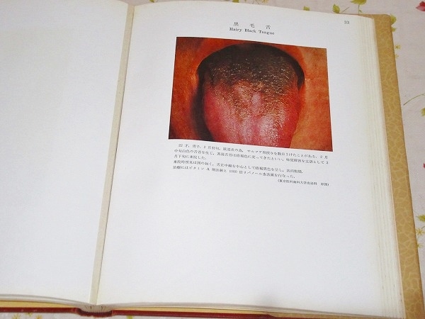 nA/日本皮膚病図譜 全4巻揃 原田儀一郎 金原出版 皮膚病　写真 医学書_画像10