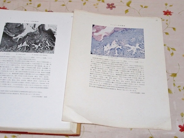 nA/日本皮膚病図譜 全4巻揃 原田儀一郎 金原出版 皮膚病　写真 医学書_画像5