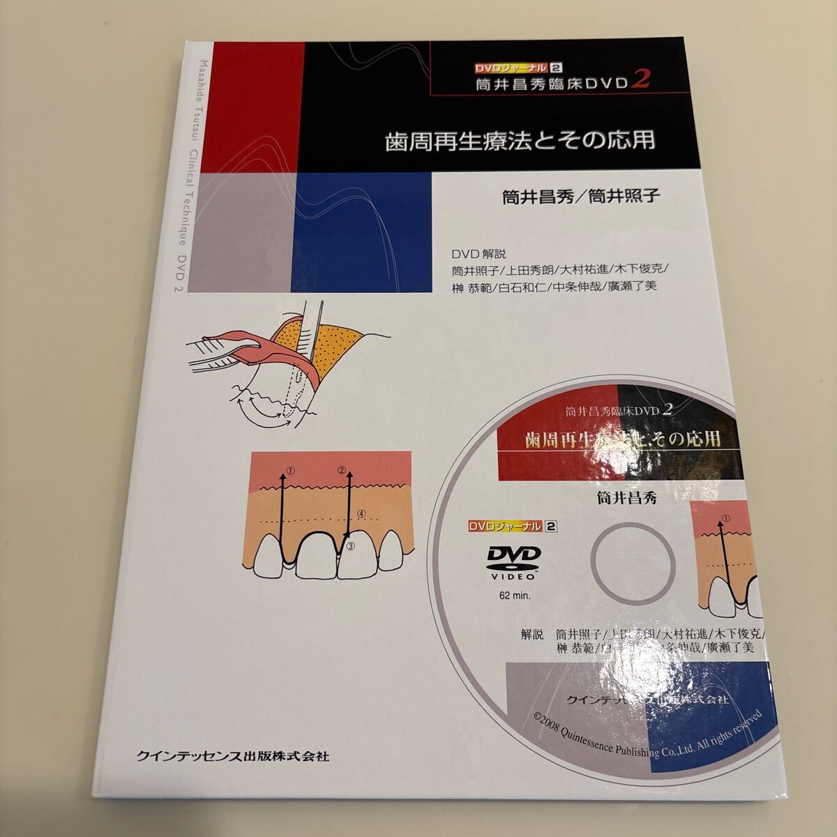 歯周再生療法とその応用　筒井昌秀臨床　２ （ＤＶＤジャーナル　　　２） 筒井　昌秀　著　筒井　照子　著