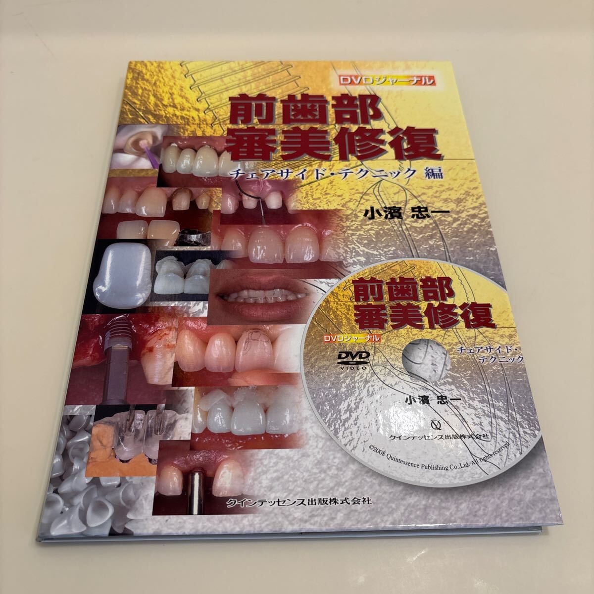 前歯部審美修復 チェアサイドテクニック編 (DVDジャーナル) 小濱忠一著　 チェアサイド テクニック編