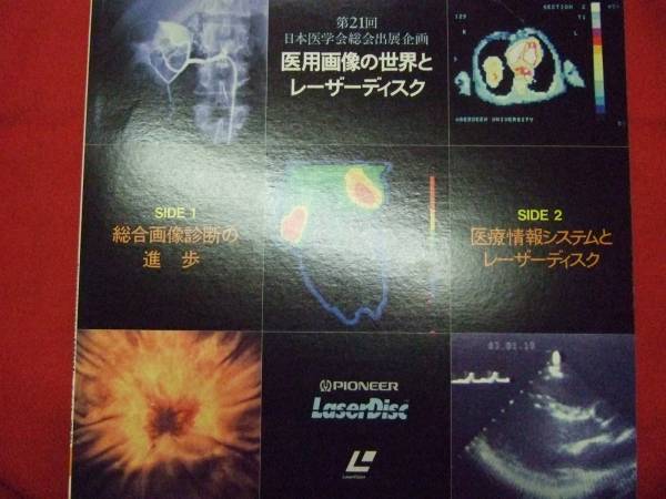 LD Japan medicine . total . exhibit plan . for pictured world . Laser 