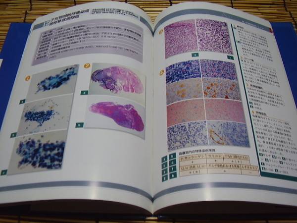 ★婦人科腫瘍病理アトラス★安田 允,田中忠夫（監(jiān)）★金原出版★